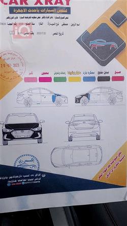 هيونداي النترا